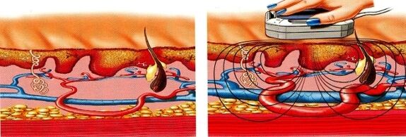 αν μουδιάσουν τα πόδια