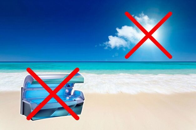 μαύρισμα με κιρσούς